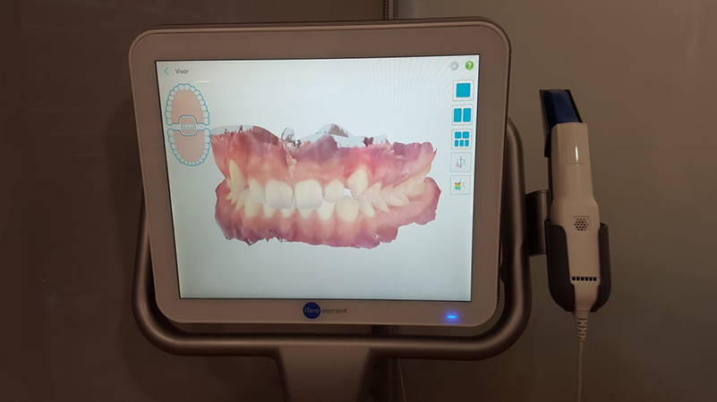 Mejor ortodoncista infantil en Coruña y clínica dental
